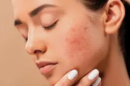 15-Home-Remedies-For-Pigmentation-During-Pregnancy