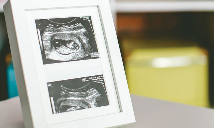 Photo frame your ultrasound report