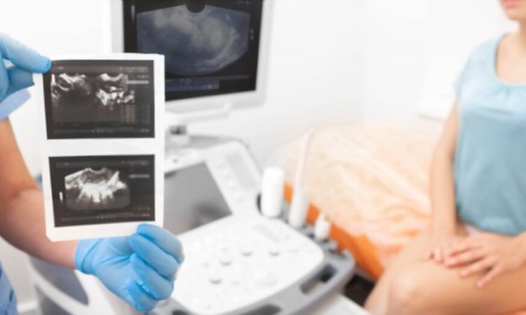 Transvaginal ultrasound examination